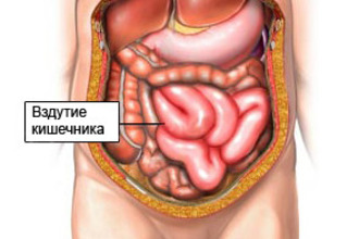 Появлению газообразования и вздутия живота способствует целый ряд факторов Живот