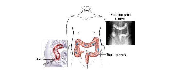 Диагностика включает проведение ряда исследований Диагноз