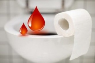 Выделения крови при опорожнении кишечника Кровь при опорожнении