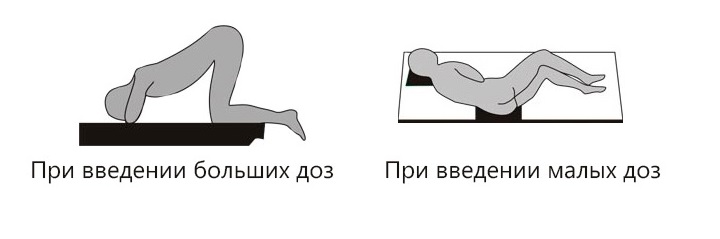 Правильные позы при введении клизмы Лечение