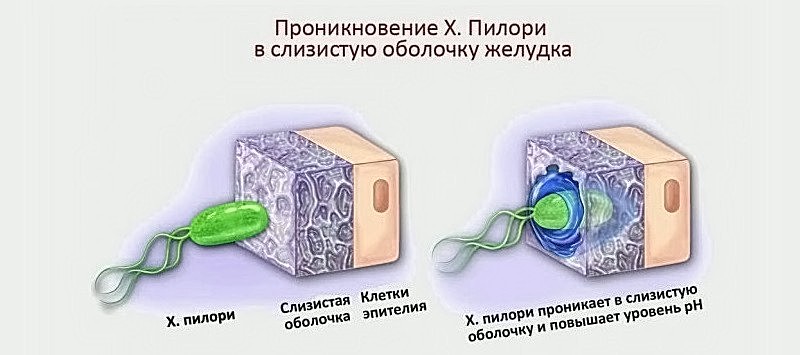 Проникновение бактерии в слизистую оболочку Проникновение Helicobacter pylori