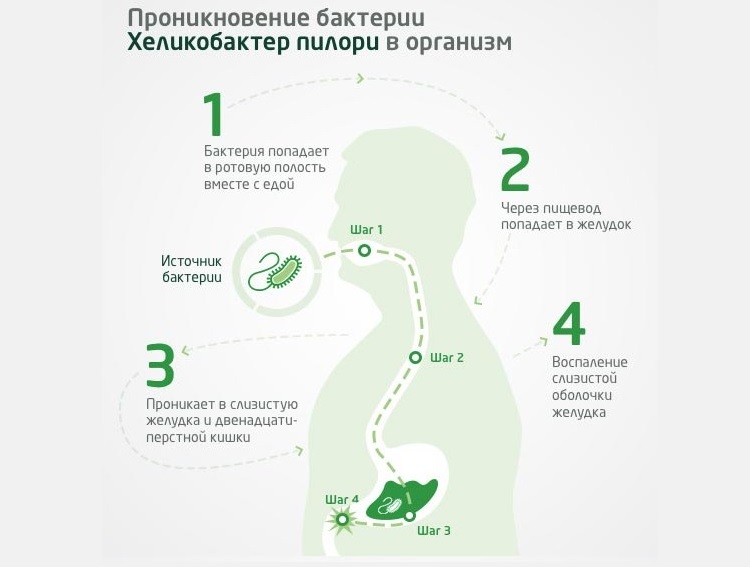Как бактерия Helicobacter pylori проникает в организм? Helicobacter pylori