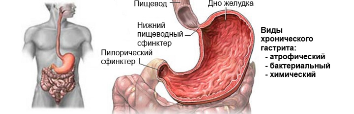 Строение желудка и виды гастрита Схема