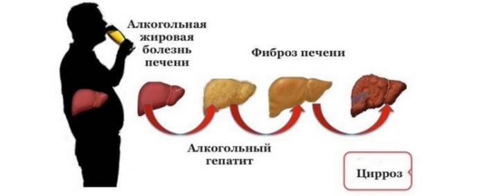 Алкогольная болезнь