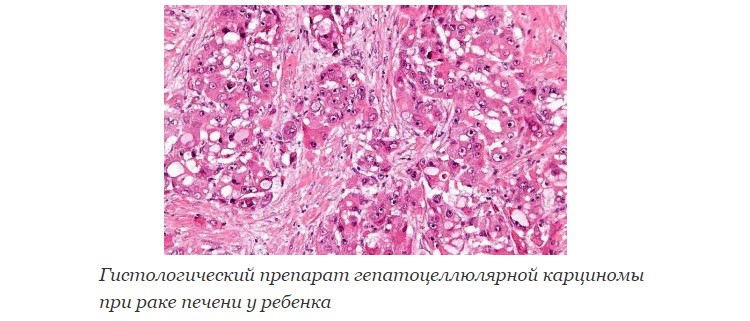 Гистологический препарат