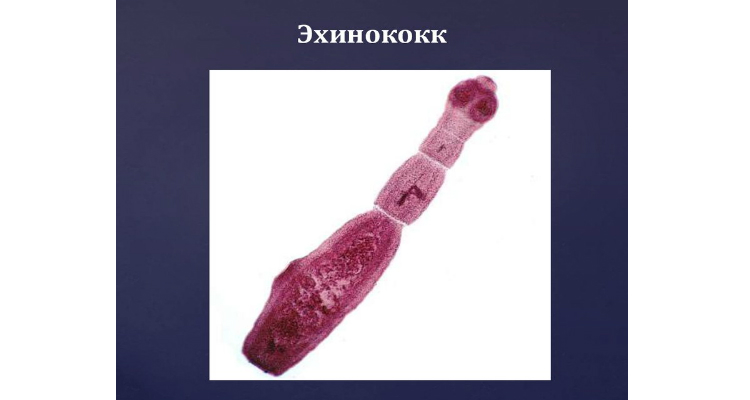 Эхинококк