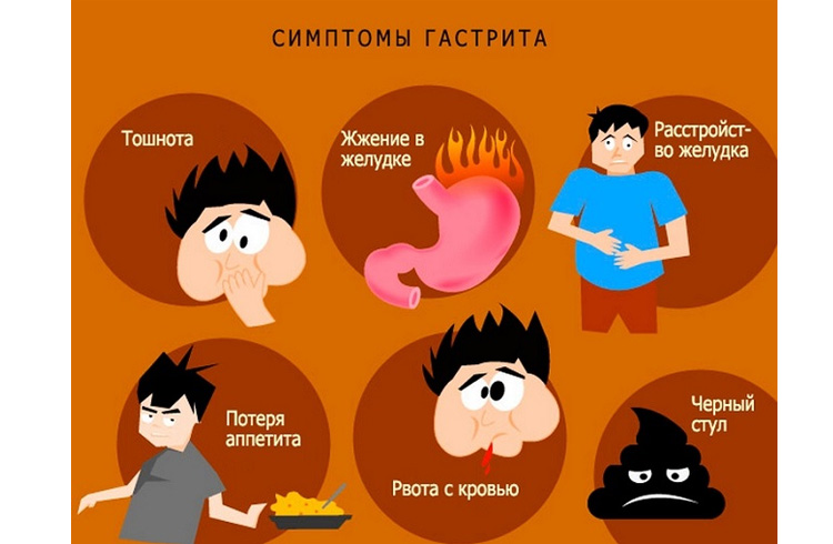 Симптомы хронического гастрита Возможные симптомы гастрита