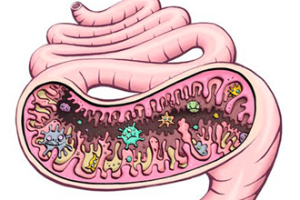 Дисбактериоз Дисбактериоз