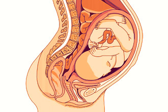 Беременность вызывает геморрой