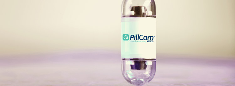 Капсульная эндоскопия