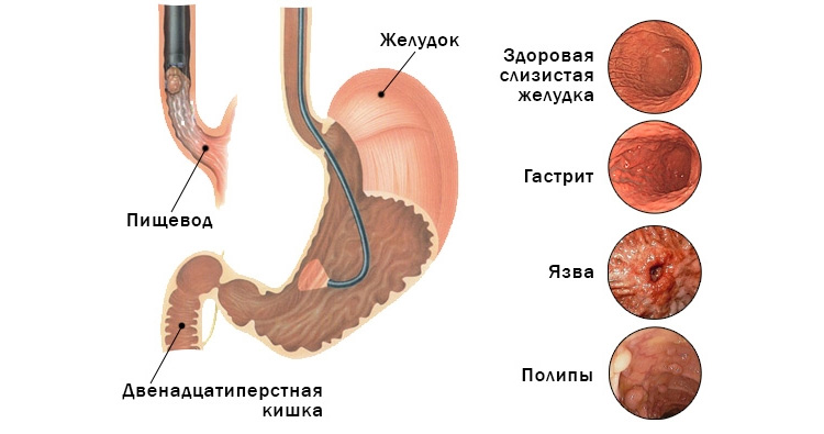 Расшифровка результатов Расшифровка результатов