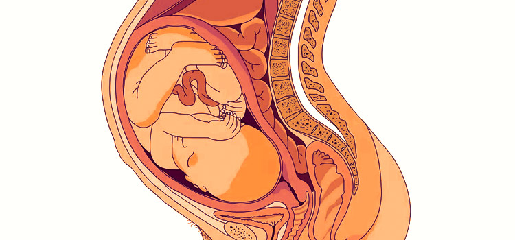 Плод беременной женщины и геморрой