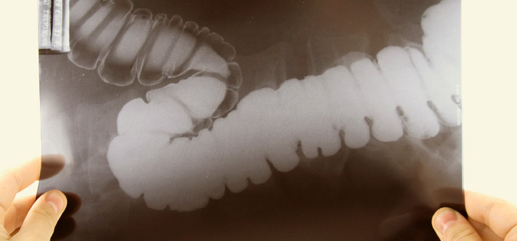 Как проходит ирригоскопия