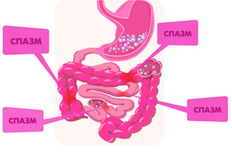Спазмы в кишечнике Спазмы в кишечнике