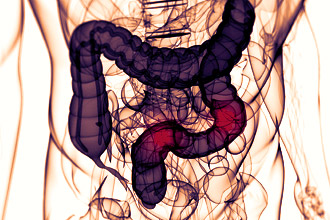 Процедура КТ кишечника