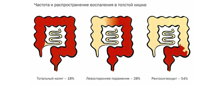 Локализация Локализация
