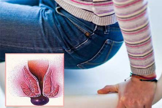 3 степень представляет серьезную опасность для больного 3 степень представляет серьезную опасность для больного